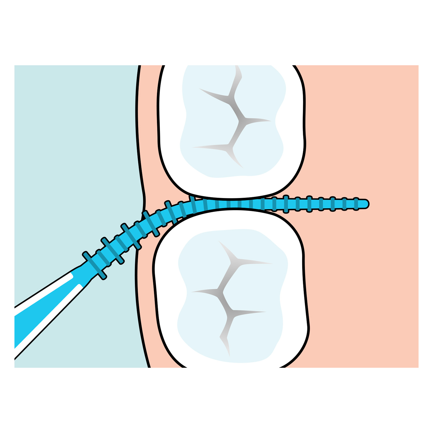 TePe EasyPick M/L 36ks